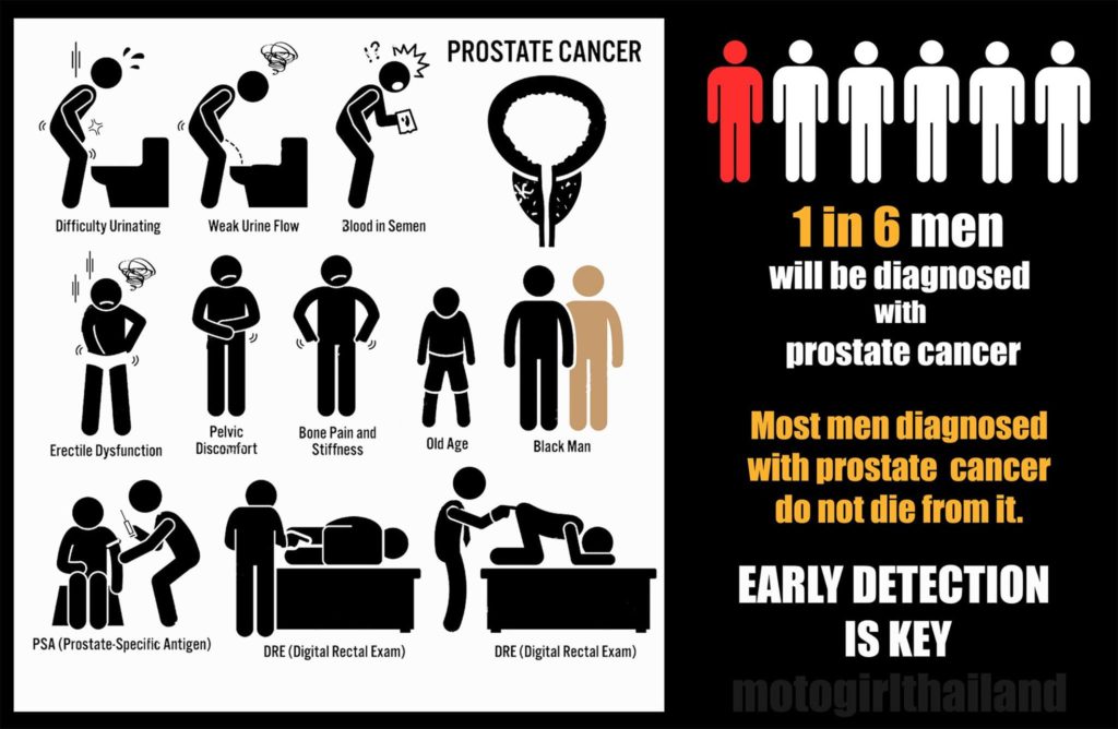 an info graphic for prostate cancer