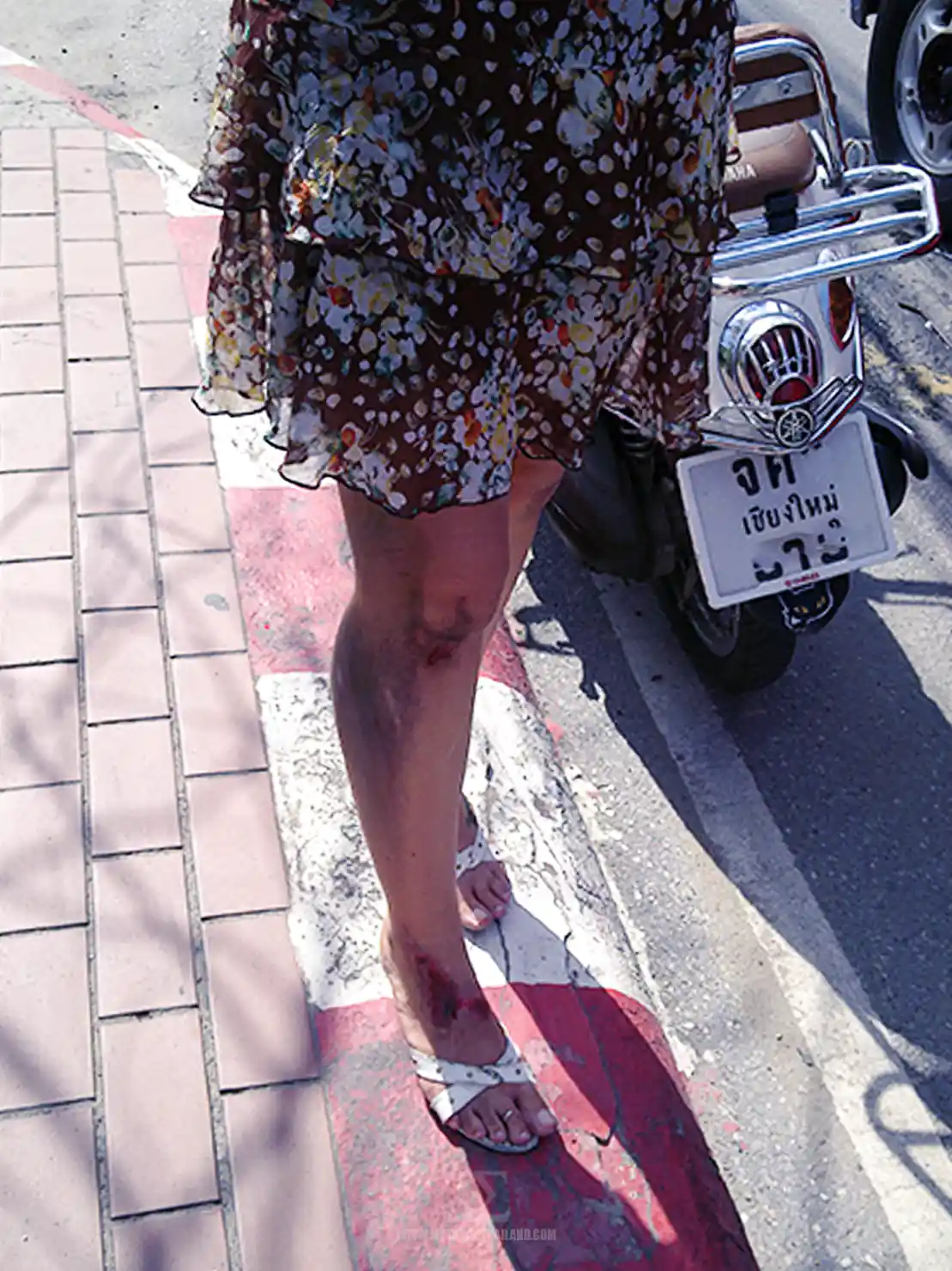 Accident July 2011