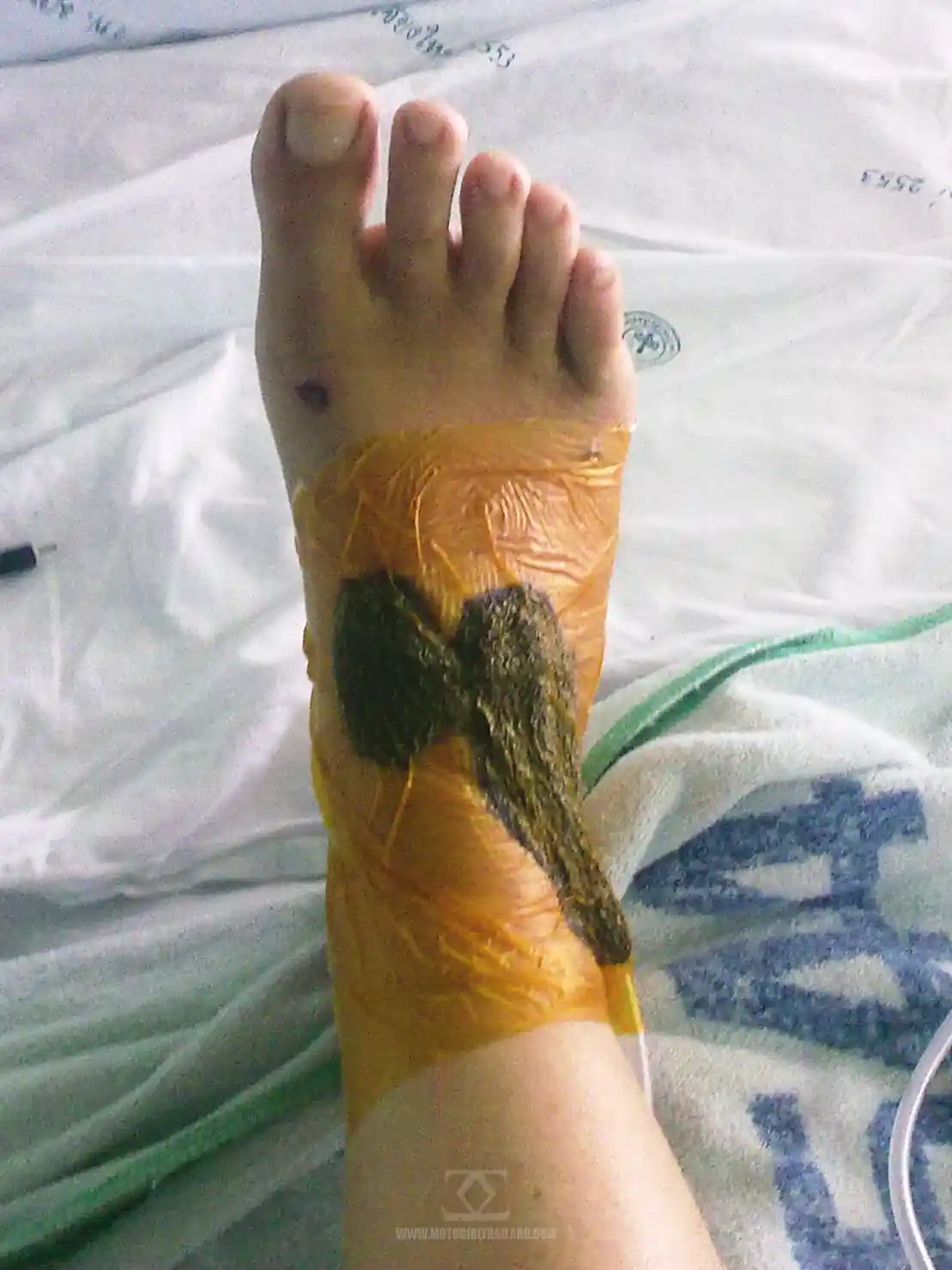 Accident July 2011