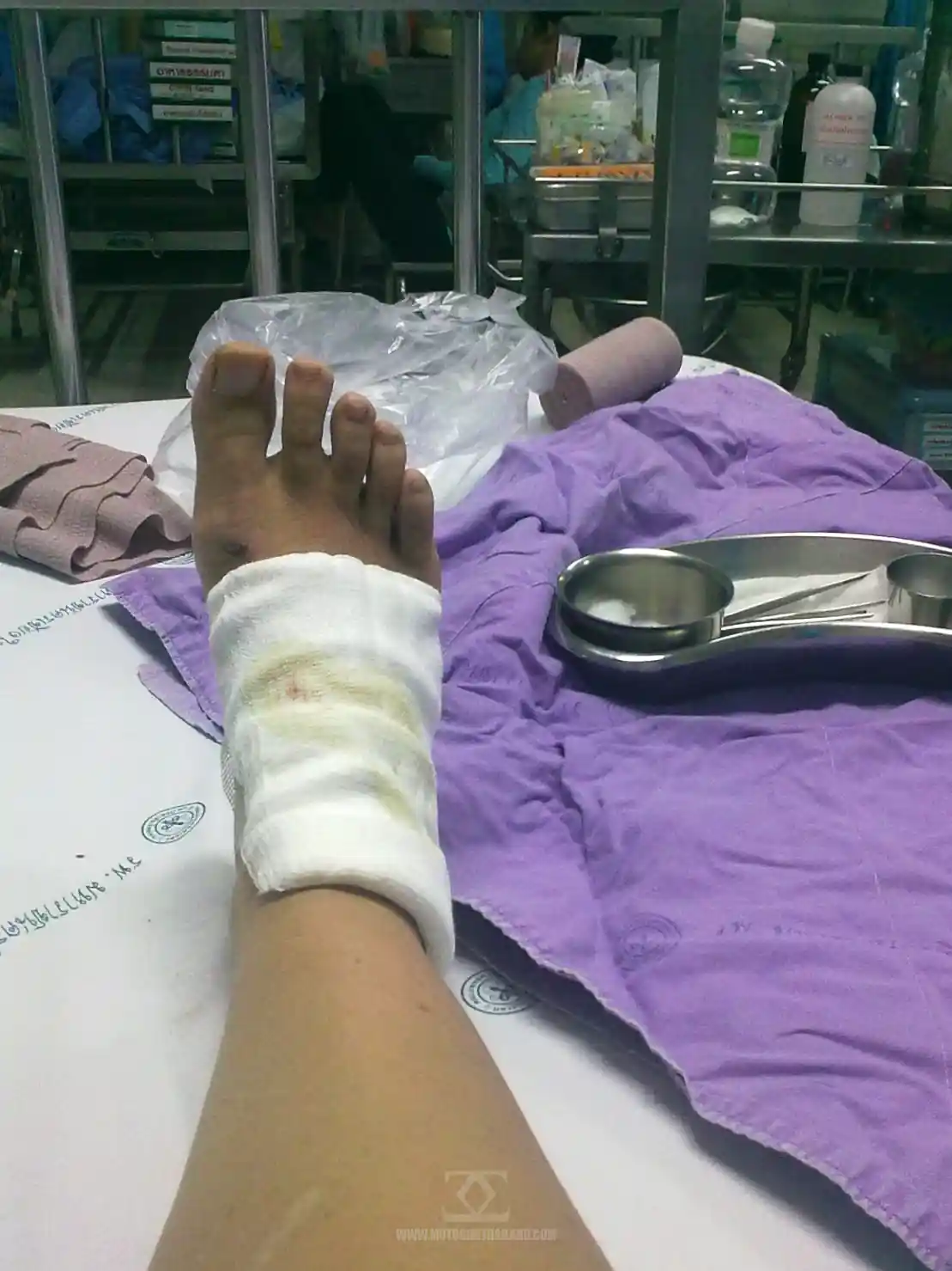 Accident July 2011