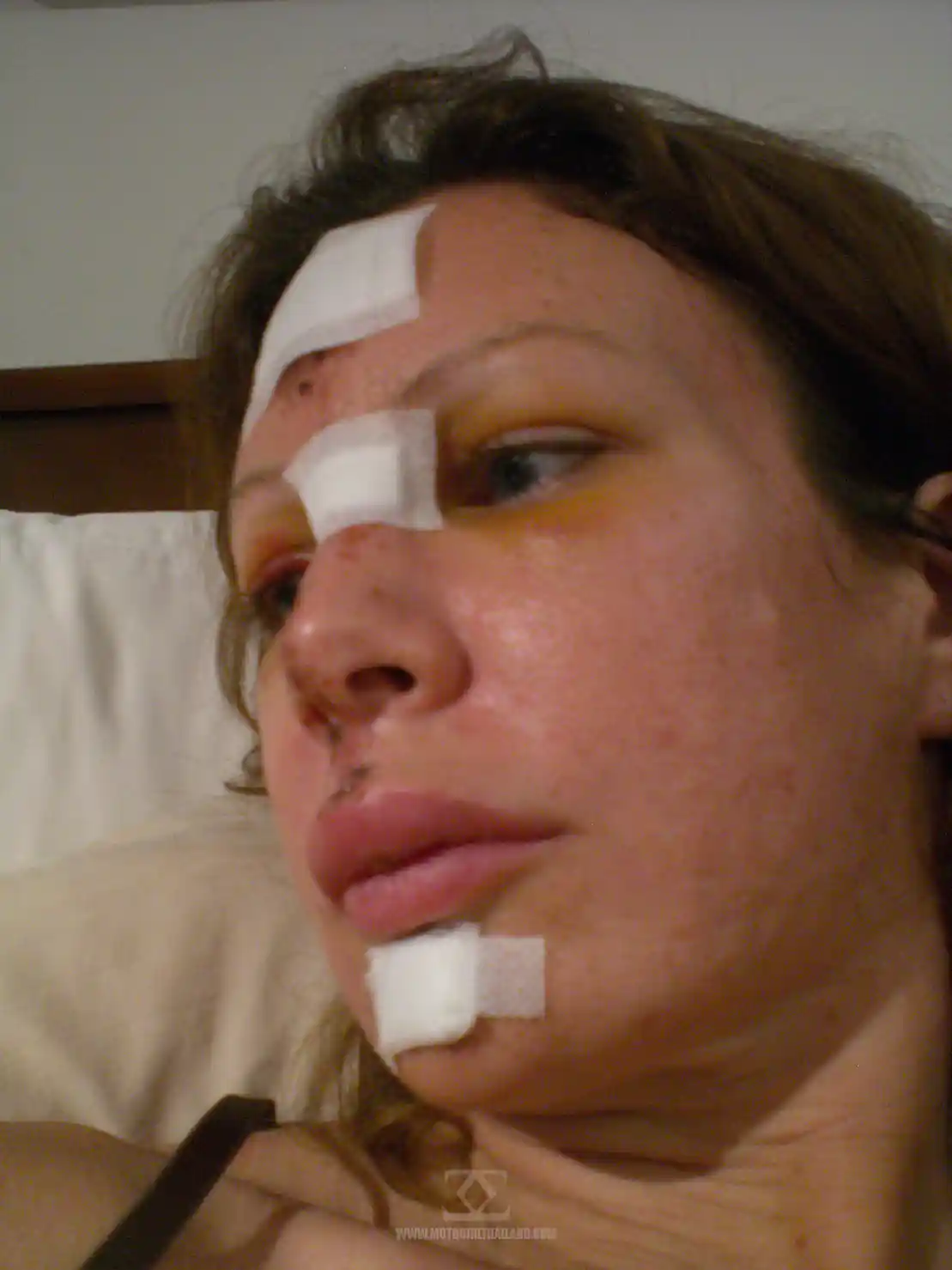 Accident Nov 2011