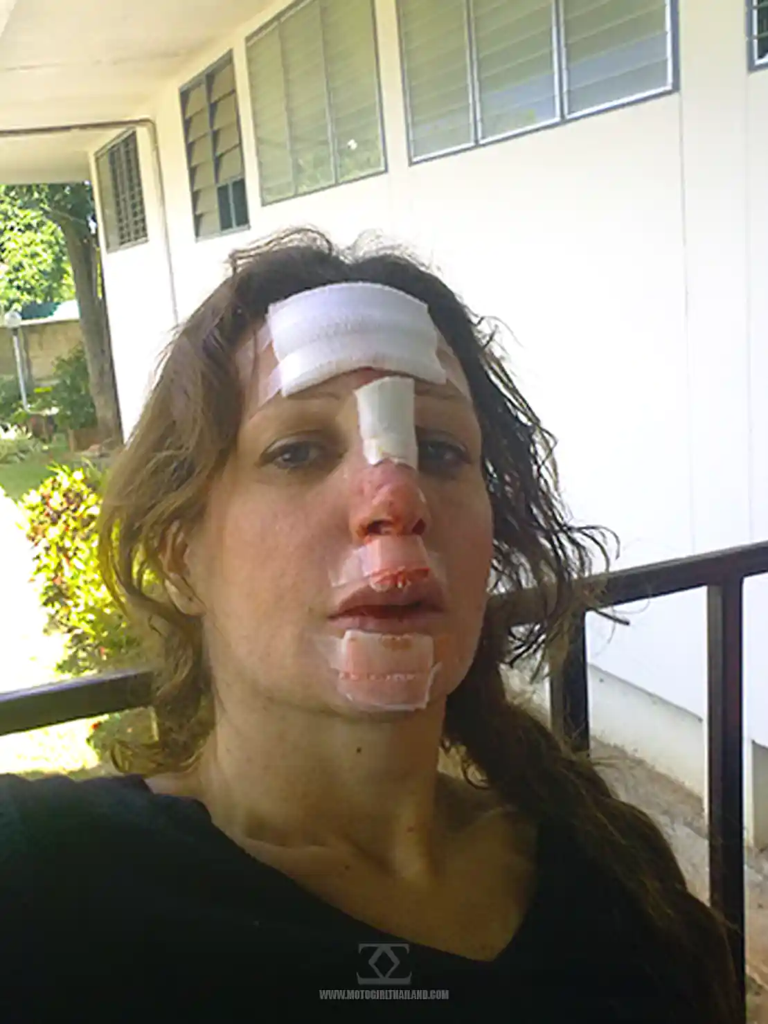 Accident Nov 2011