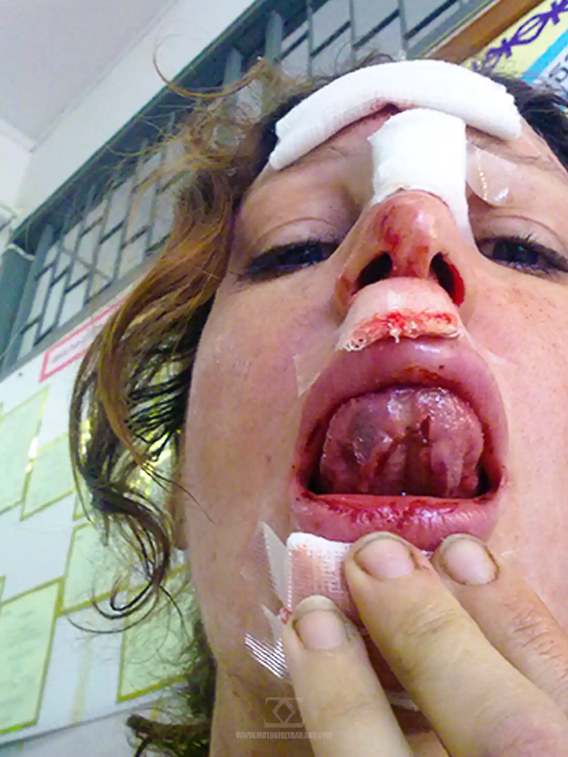 Accident Nov 2011