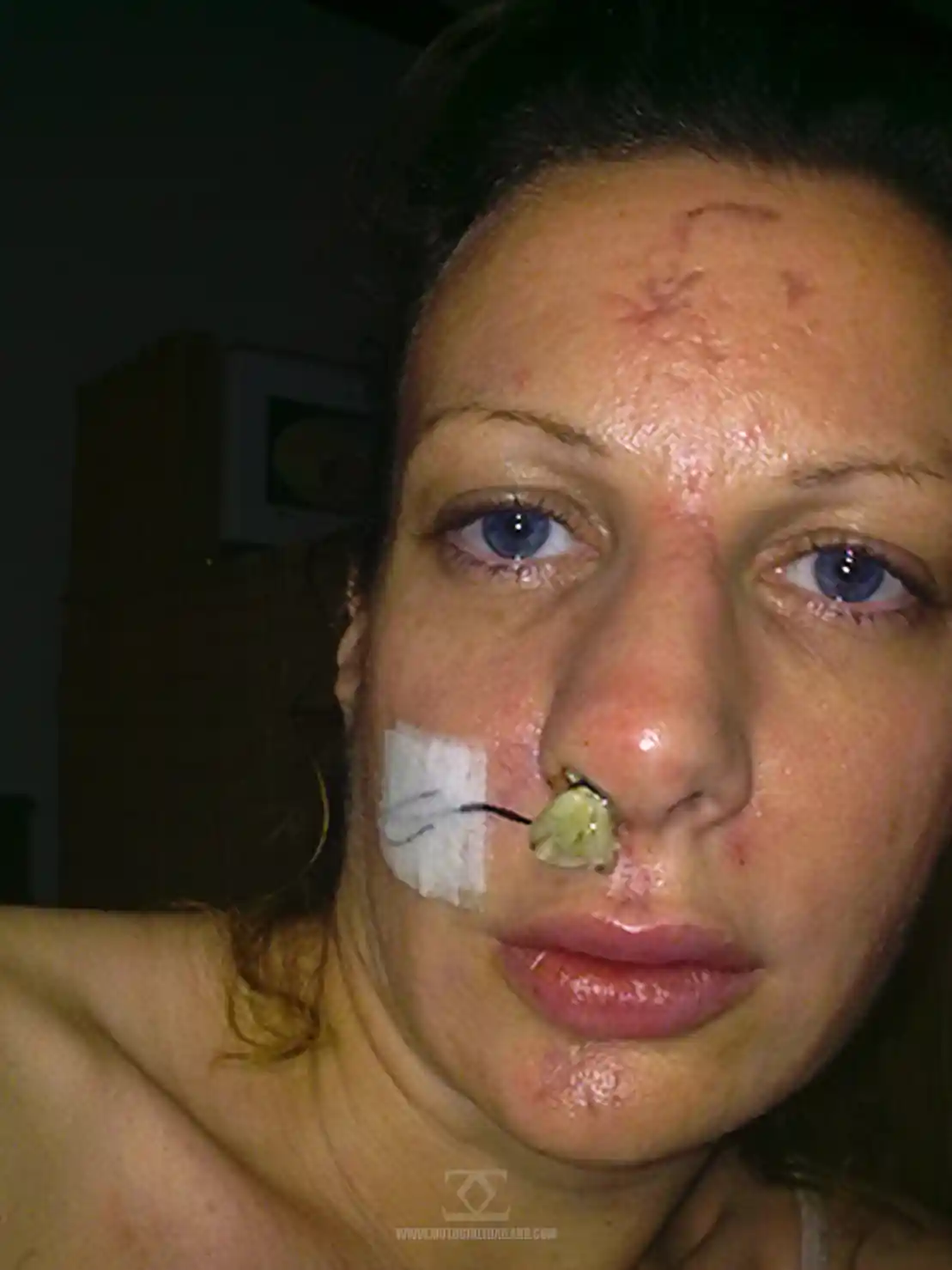 Accident Nov 2011