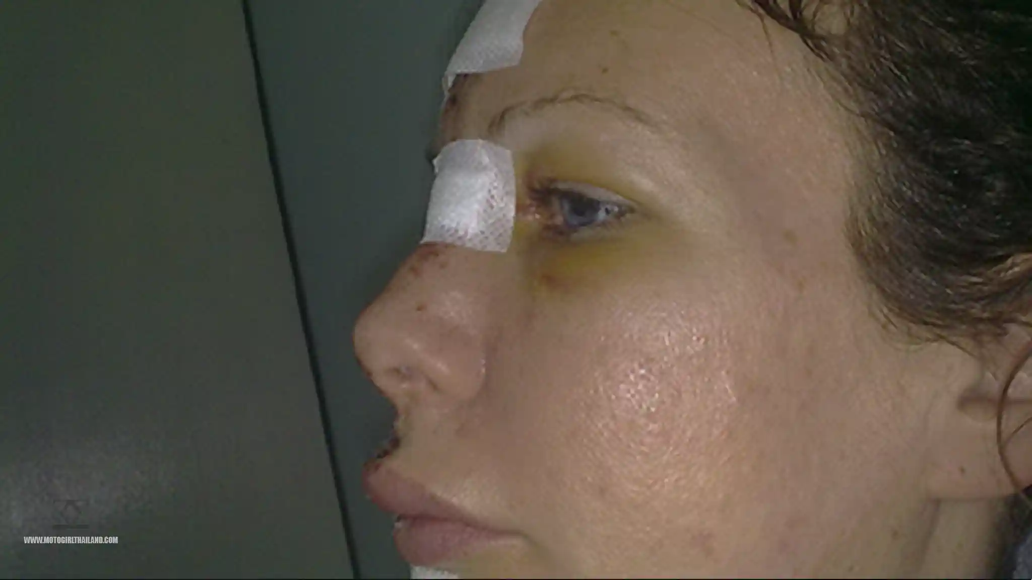Accident Nov 2011