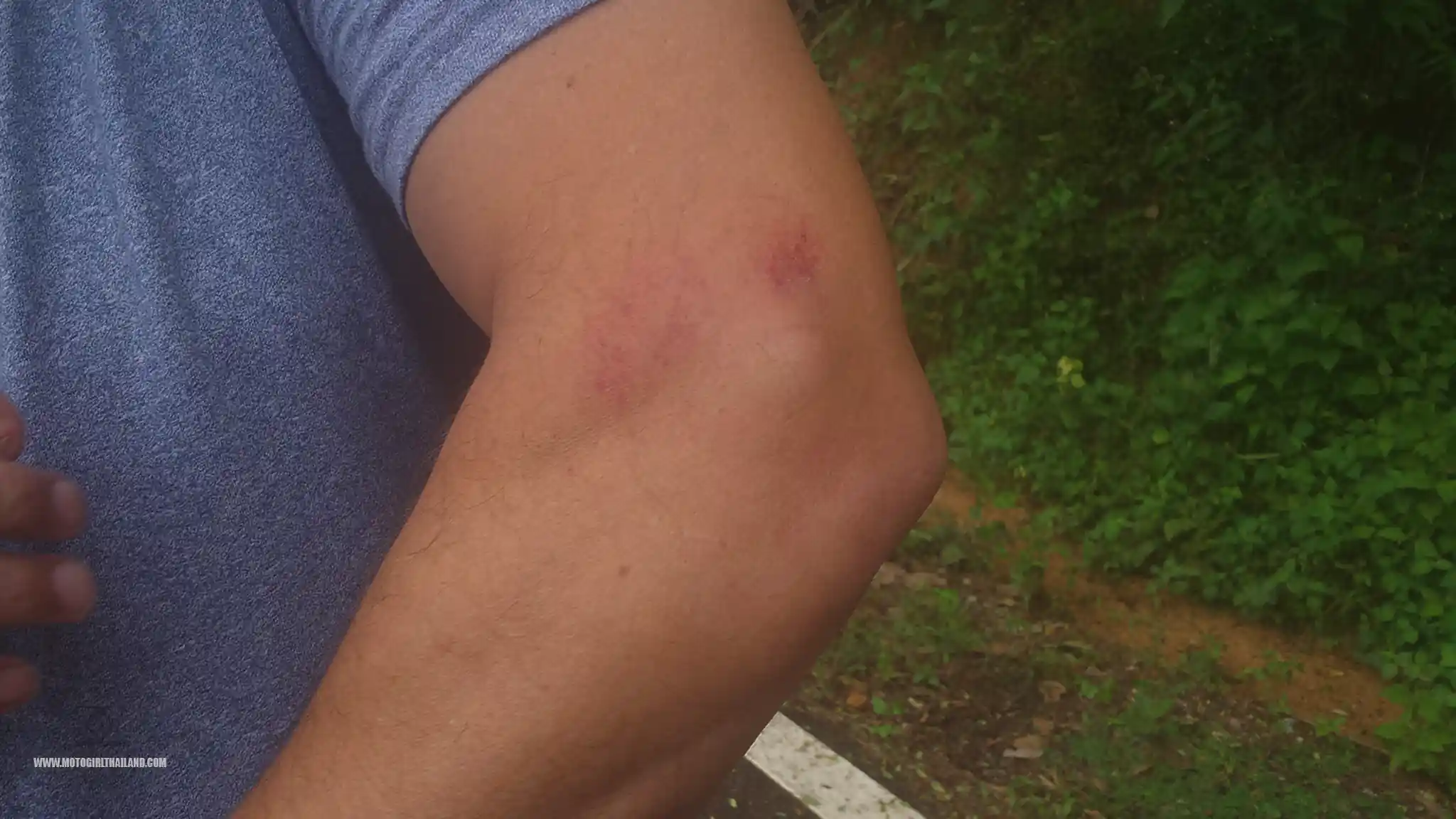 TBB Bike Fall